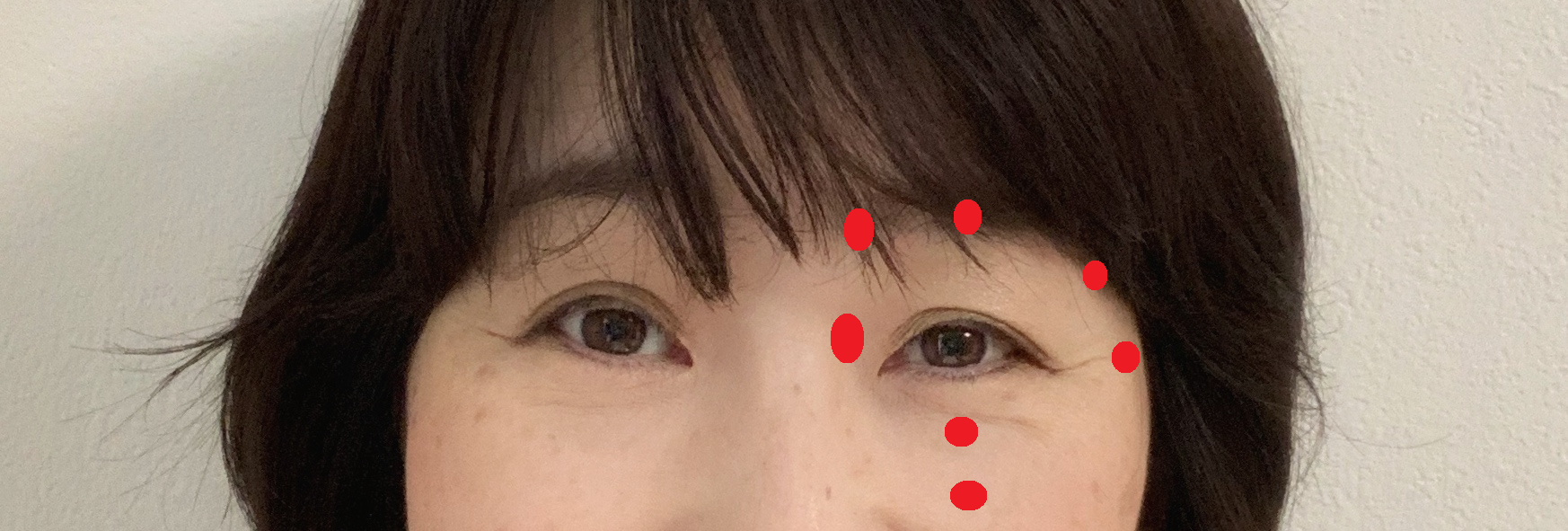 眼精疲労にきくツボ